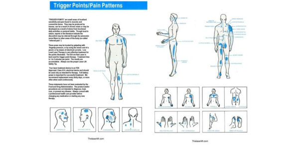 Canine Trigger Point Chart